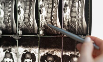 Is cannabis beneficial for degenerative disc disease and back pain? 